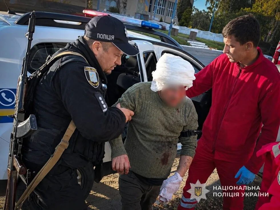 На Сумщині поліцейські врятували чоловіка з ампутаційною травмою після вибуху